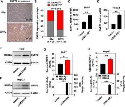 Hepatitis B Virus Promotes Hepatocellular Carcinoma Progression Synergistically With Hepatic Stellate Cells via Facilitating the Expression and Secretion of ENPP2